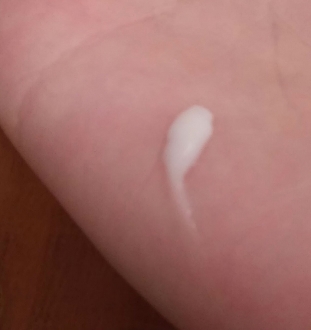 αιτίες της βλέννας